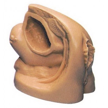 ADVANCED FEMALE CATHETER MODEL (SOFT)